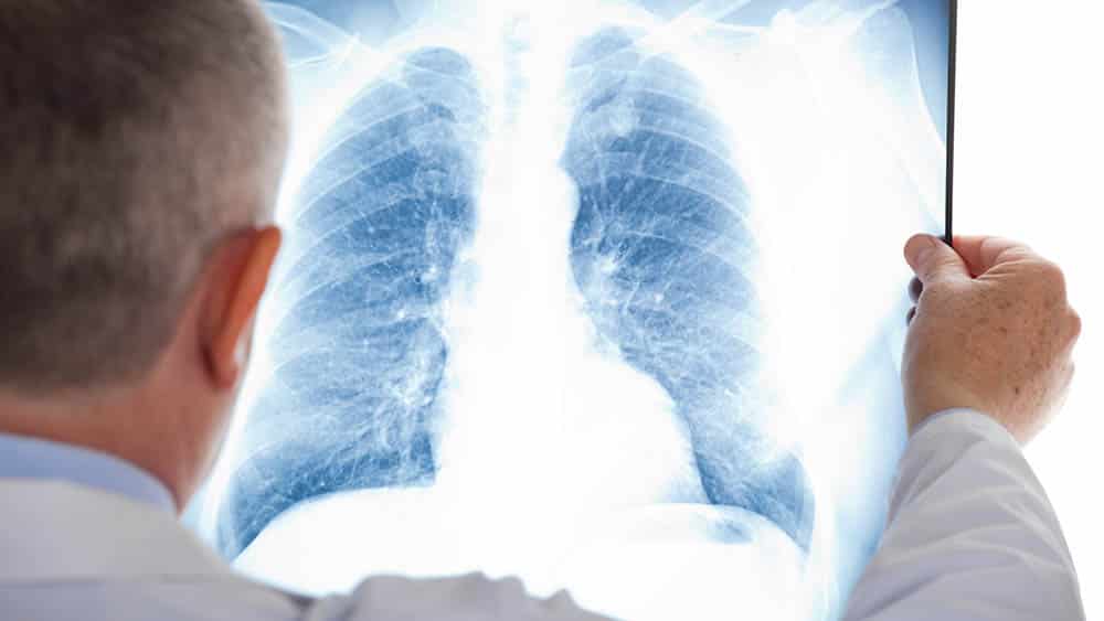 TRF3 concede aposentadoria por invalidez a ambulante portador de doença pulmonar
